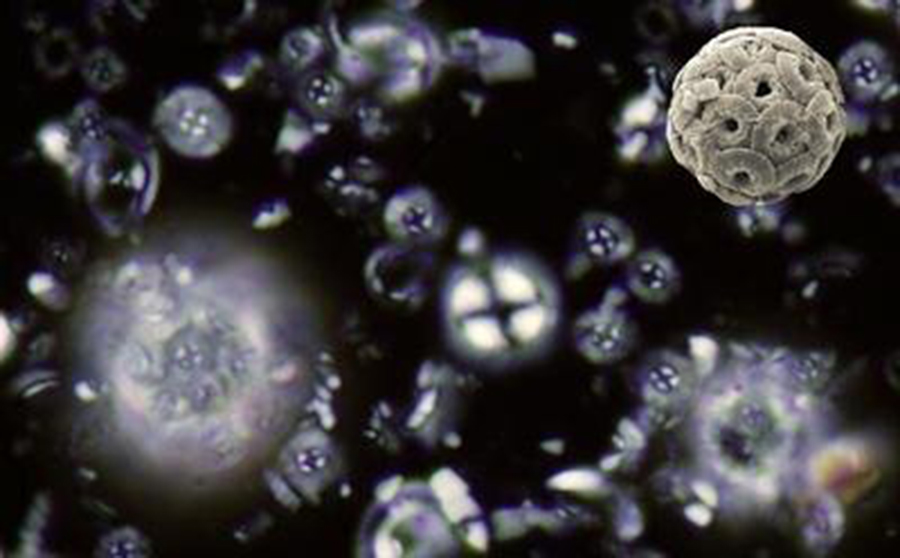 Microscopic nanoplankton fossils. Credit: Samantha Gibbs/Paul Bown