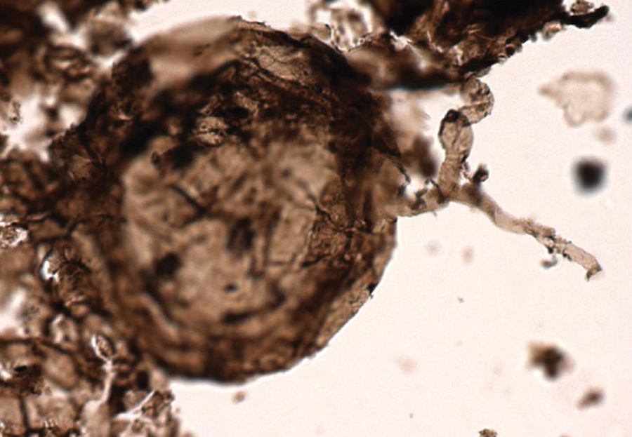 Microphotograph of Ourasphaira giraldae. Image credit: Loron et al, doi: 10.1038/s41586-019-1217-0.