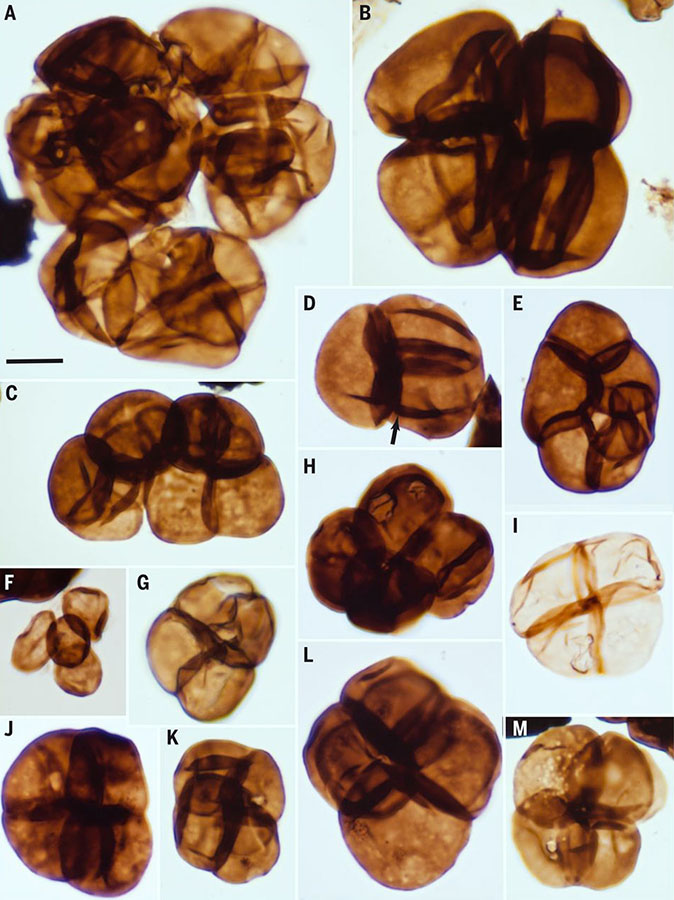 Fossilized spores from the Early Ordivician deposits of Australia. Image credit: Strother & Foster, doi: 10.1126/science.abj2927.