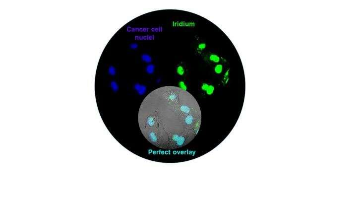 The purple stain for cancer cell nuclei overlaps perfectly with the emission of green light from the iridium-albumin conjugate, showing the protein has delivered the photosensitiser to the nucleus of cancer cells. Credit: University of Warwick