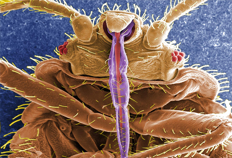 This digitally-colorized scanning electron micrograph revealed some of the ultrastructural morphology displayed on the ventral surface of Cimex lectularius; from this view you can see the insect’s skin piercing mouthparts it uses to obtain its blood meal, as well as a number of its six jointed legs. Image credit: Janice Harney Carr, CDC.