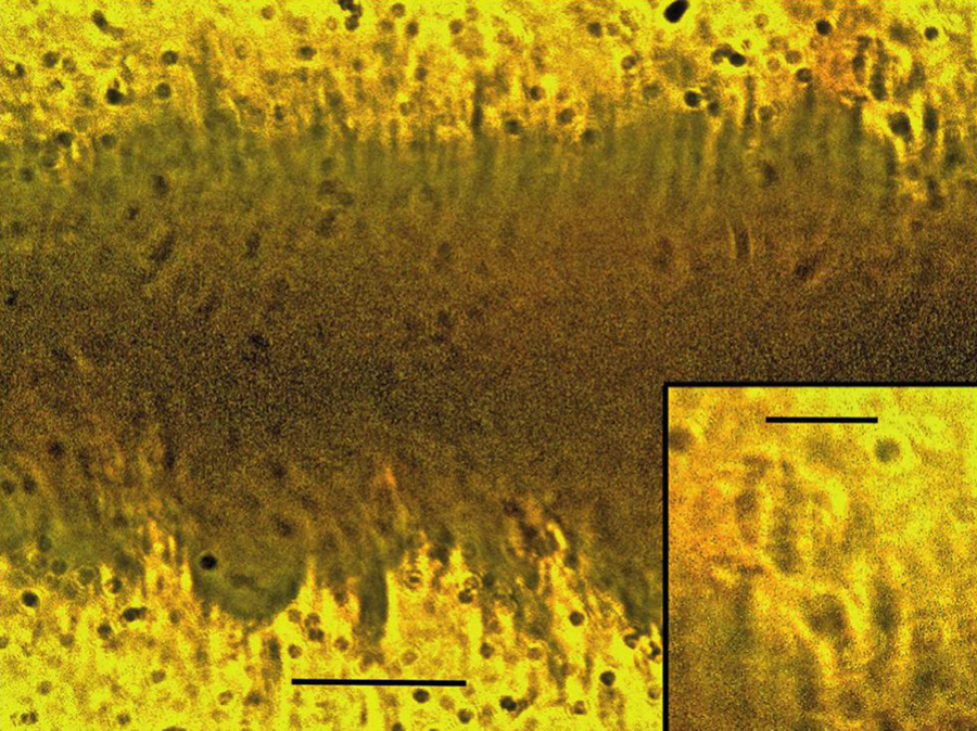 Pollen catching hairs with surrounding pollen grains on the hind leg femur of Discoscapa apicula in Burmese amber. The insert shows branches on hairs. Scale bars – 213 µm and 50 µm (insert). Image credit: Poinar Jr, doi: 10.18476/pale.v13.a1.